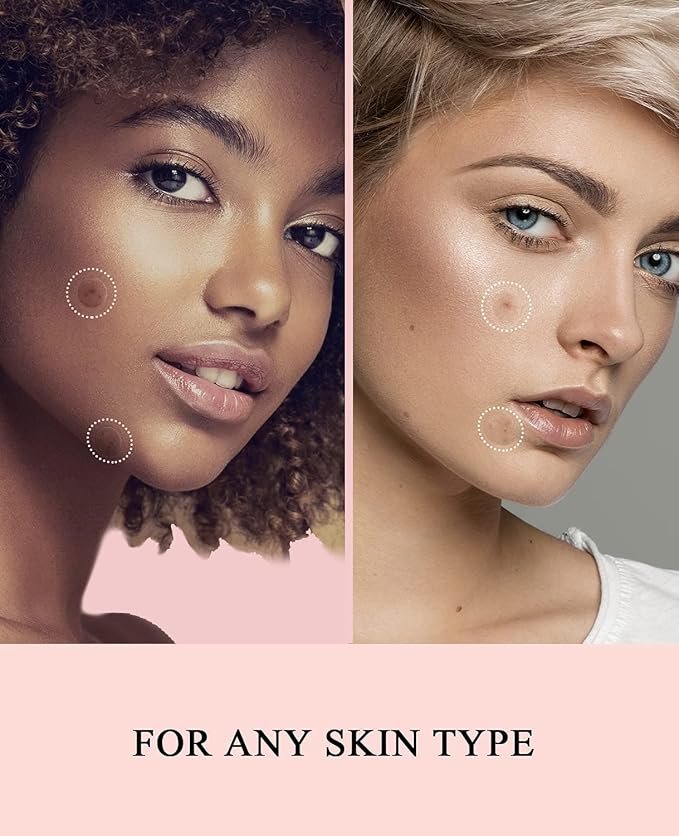 Acne Patches Pimple Patches for Face 4 Sizes 528 Count