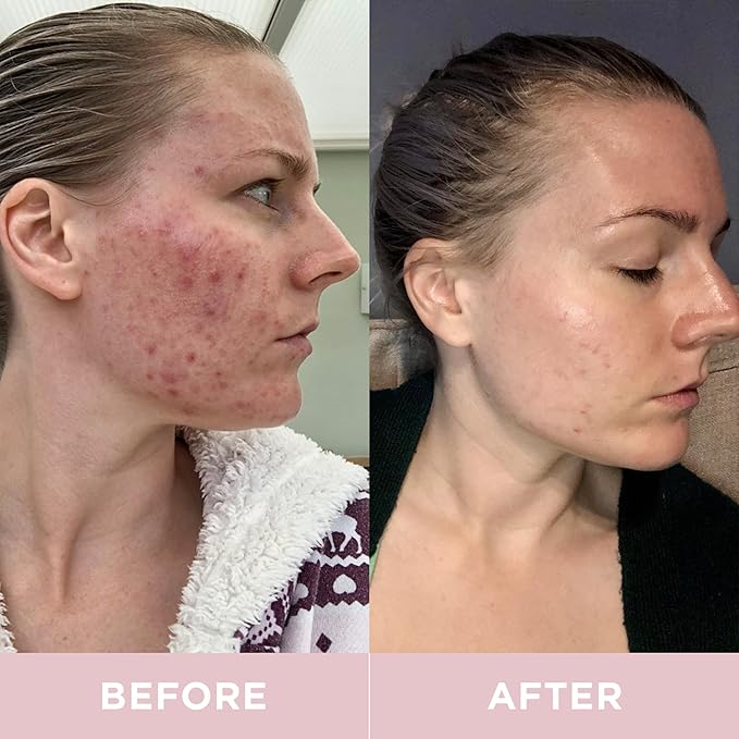 Premium 8,500mg Hydrolyzed Marine Collagen Supplements Drink with Added Hyaluronic Acid & Aloe Vera for Healthy Skin, Hair, Nails & Joints | Lemon & Lime (14 Days Supply)