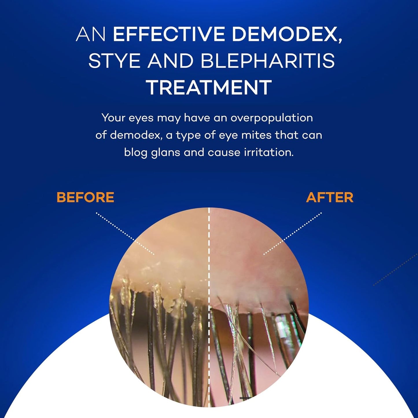 Zocular - Zocuwipe Eyelid Wipes with Natural Okra Complex - Eyelid Cleanser and Moisturizer Pads - Eyelid Cleansing Wipes - Blepharitis Treatment - 15ct