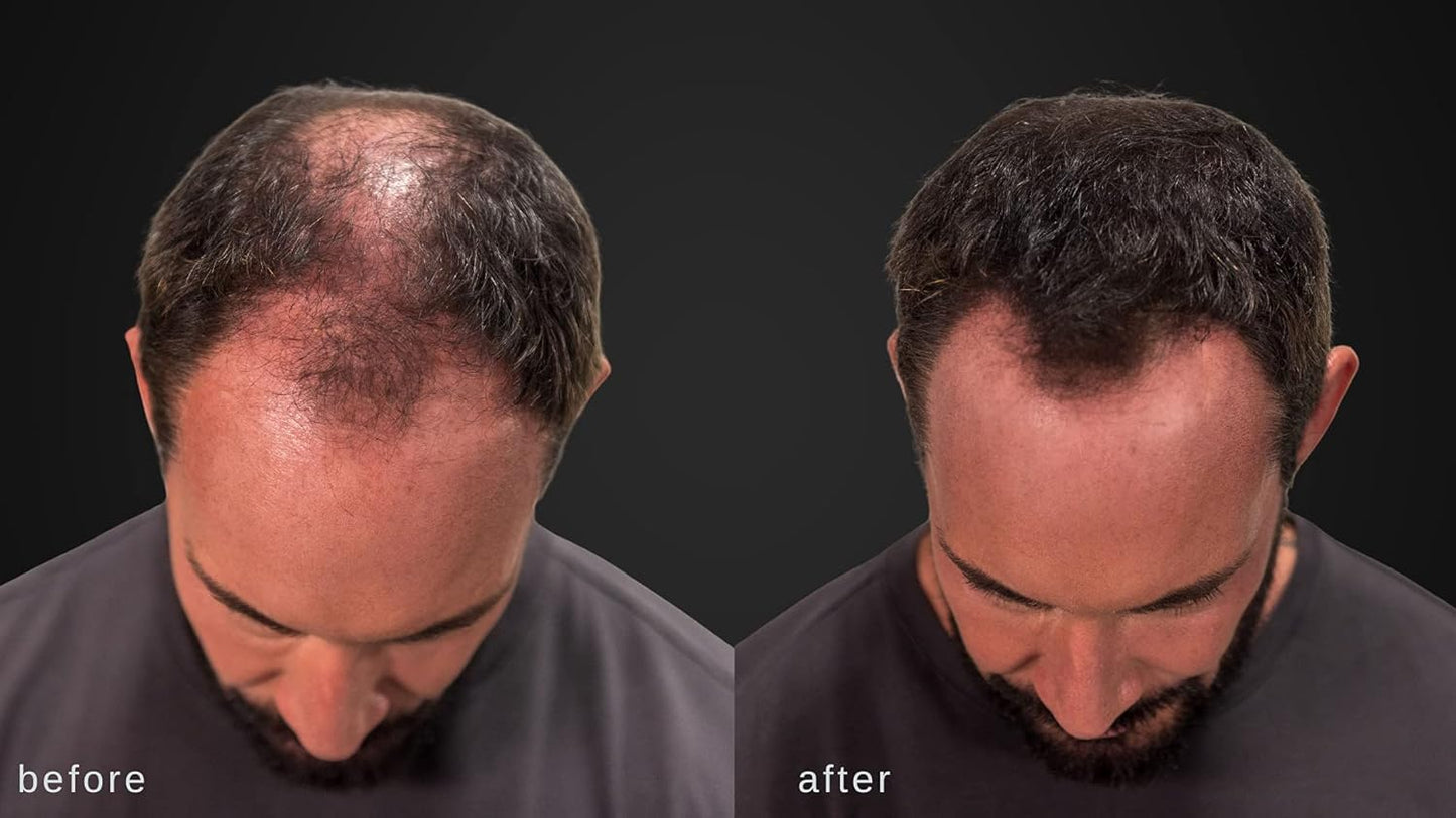 LUXE Hair Building Fibers - Thickening Fibers - CONFIDENCE IN A JAR – 2 Months+ Supply! – Hypoallergenic, Dermatologist Tested – Multiple Colors Available (Gray)