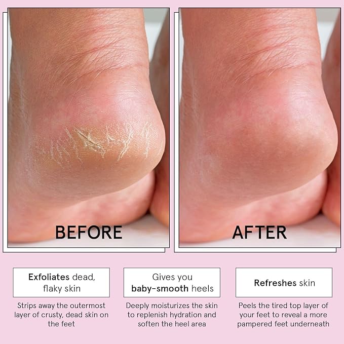 grace & stella Award-Winning Foot Peeling Mask - Foot Peel Masks with Aloe Vera- Moisturizing Foot Masks That Remove Dead Skin, Exfoliating Foot Mask for Dry Cracked Feet (4 Pairs, Unscented)