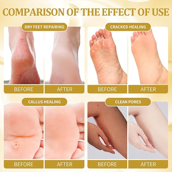 Pedicure Kit Foot Soak Set: Bubble Salt, Sugar Scrub, Massage Mask, Massage Lotion in a Box, 4 Step Foot Spa Kit for Dry Feet, Tired Feet（3 Set Honey flower)