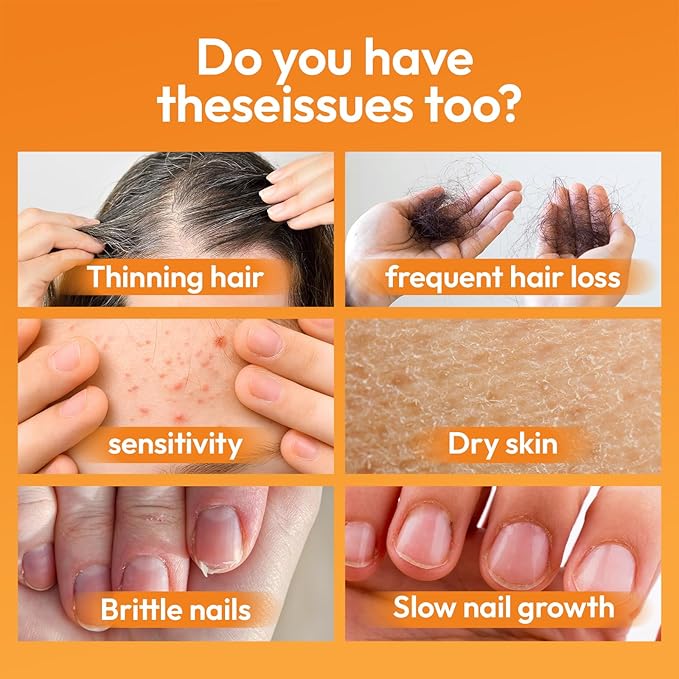 Biotin 10000 mcg with Zinc Vitamin C & Calcium Pantothenate – Supports Healthy Hair Growth, Strong Nails & Glowing Skin for Women & Men | Made in The USA | 60 Vegan Capsules (2 Months Supply)