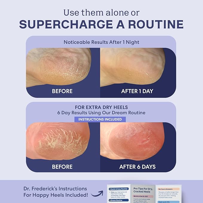 Dr. Frederick's Original Moisturizing Fuzzy Heel Socks - 2 Pairs - Cozy Gel-Lined Sleep Socks for Women & Men - Soothes Dry, Cracked Feet - Heel Repair - Lavender Luxury