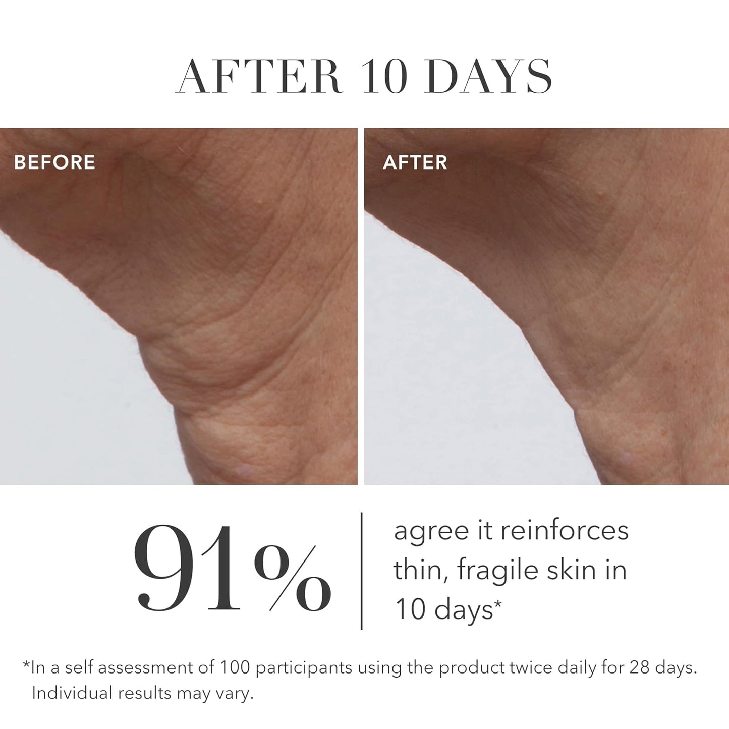 Algenist GENIUS Ultimate Anti-Aging Cream, Travel Size - Vegan Firming & Smoothing Moisturizer with Alguronic Acid & Microalgae Oil - Non-Comedogenic & Hypoallergenic Skincare (0.5 oz)