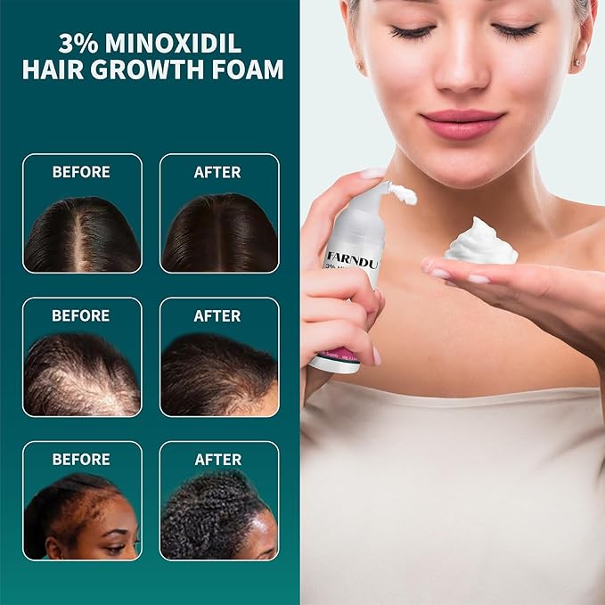 Hari Mask & 3% Mnoxidil Foam