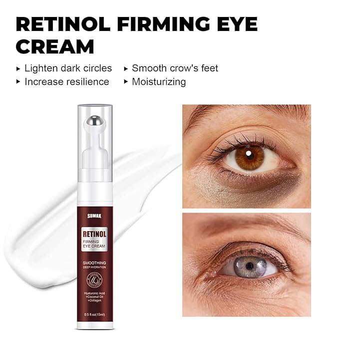 Advanced Retinol Eye Cream With Hyaluronic Acid,Coconut Oil and Collagen,Under Eye Cream for Dark Circles, Reduces Puffiness & Under Eye Bags