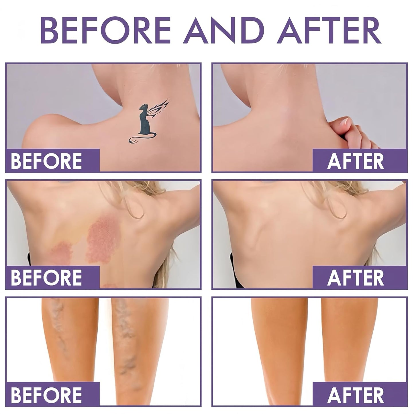 Waterproof Body Concealer For Legs And Body,Tattoo And Scar Cover Foundation,Natural Radiance, High Coverage, Transfer Resistant Body Makeup (Brush Included) 2.5oz