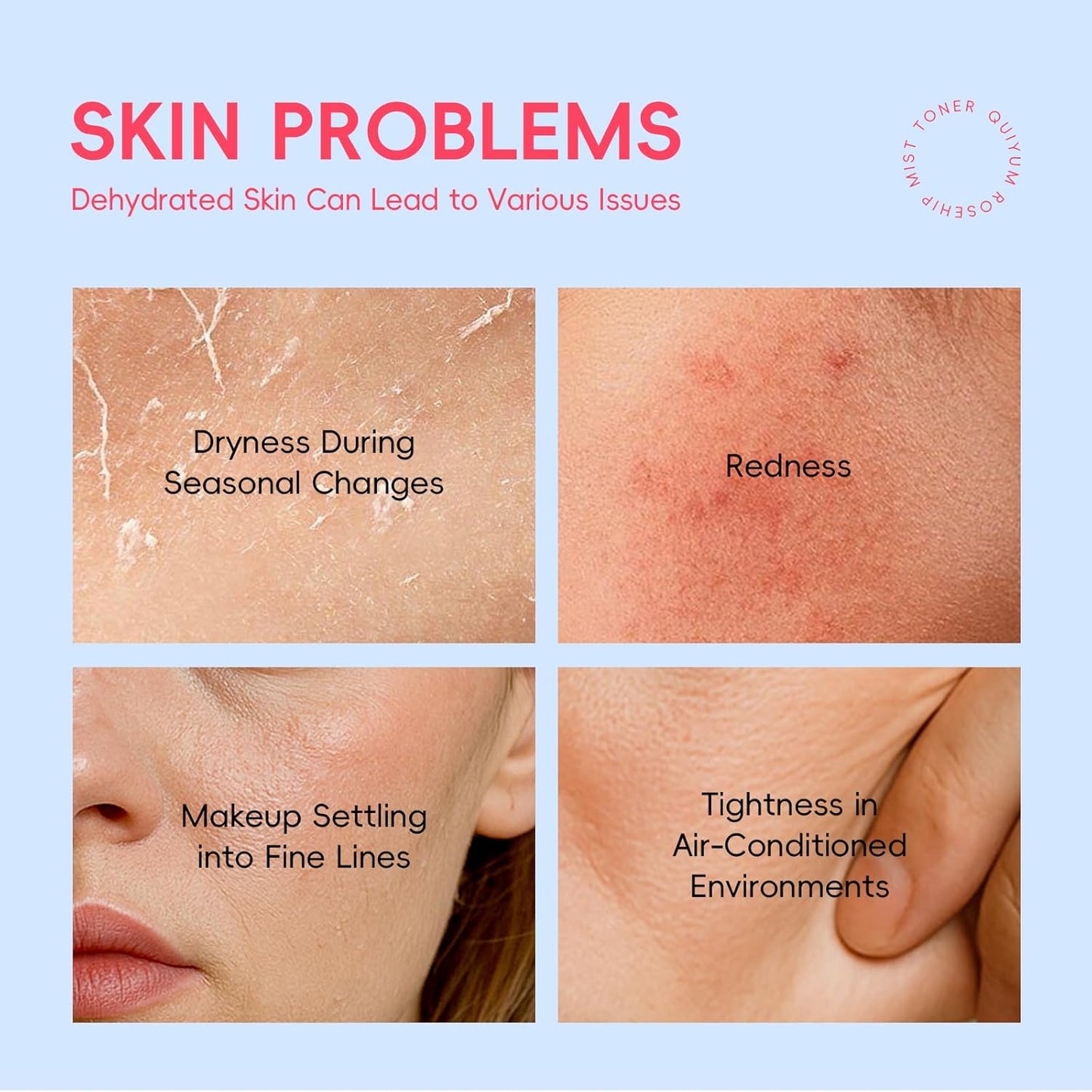 Rosehip Skin Care Sets for Women, Nourishes, Resists Oxidation, Promotes Collagen Production, Refine skin texture, Enhances Skin Elasticity, Korean Style Skincare Gift Se, Travel Set 4PCS