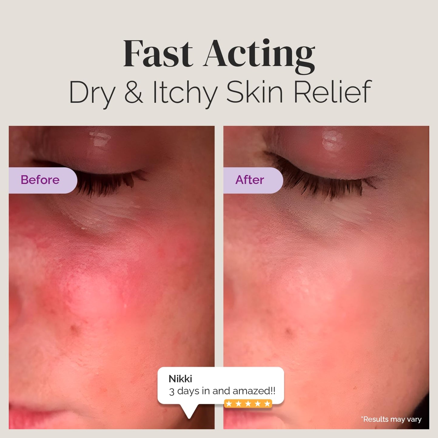 Puriya National Eczema Association Accepted Cream 2 oz, Dry Itchy Skin Relief, Colloidal Oatmeal Lotion, For Kids, Adults, Face, Hands, Mother of All Creams, Plant-Based Hydration,No Fragrance Added