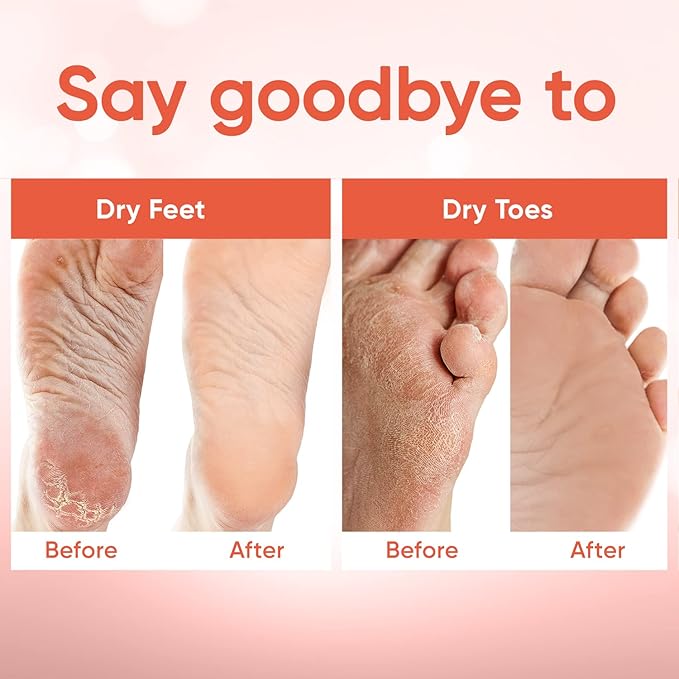 Foot Peel Mask - Foot Mask for Baby Soft Skin - Remove Dead Skin, Dry, Cracked Feet & Callus, Foot Spa, Made with Aloe Vera Extract for Women and Men (5 Pair (Pack of 1), Peach)