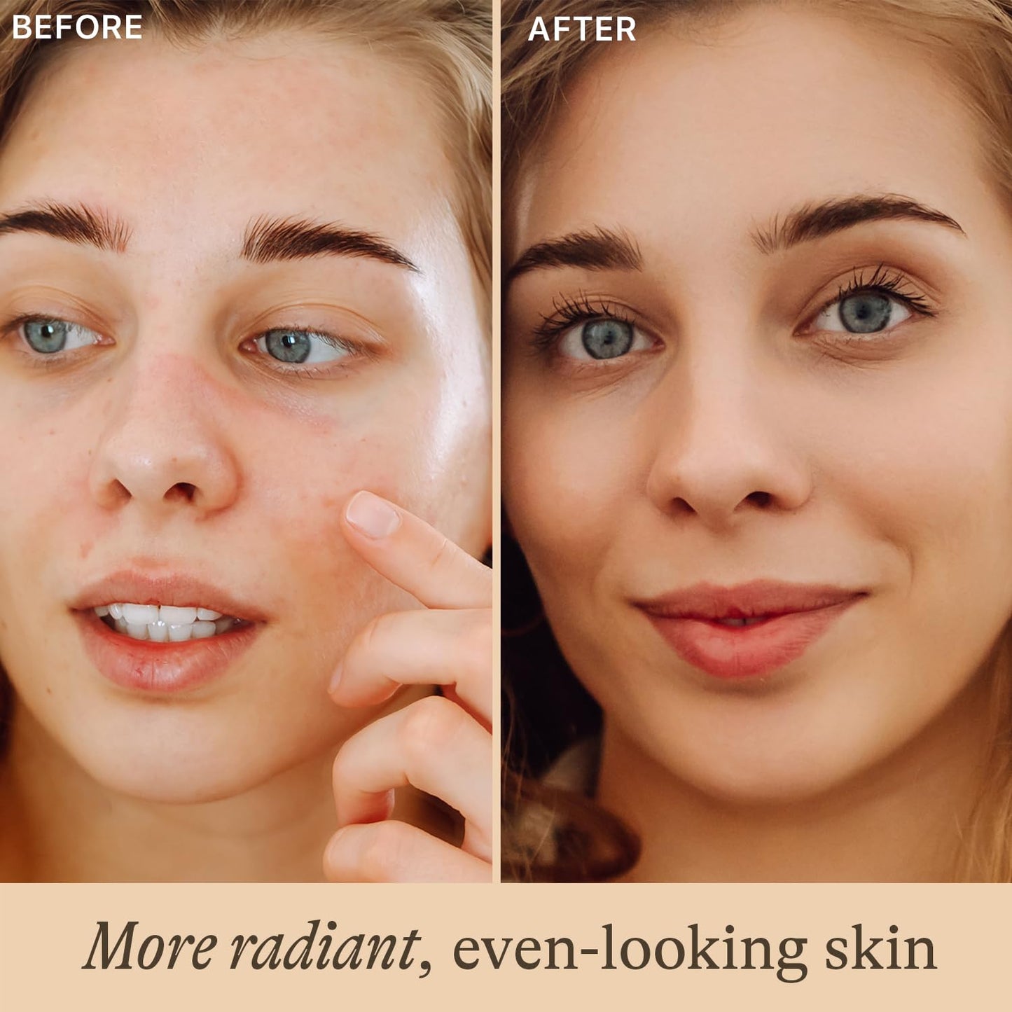 Vitamin C Face Serum - USA Made with Natural & Organic Ingredients, Skin Brightening Vitamin C Serum for Face for Women, Discoloration Correcting & Anti Aging Facial Formula with Antioxidants