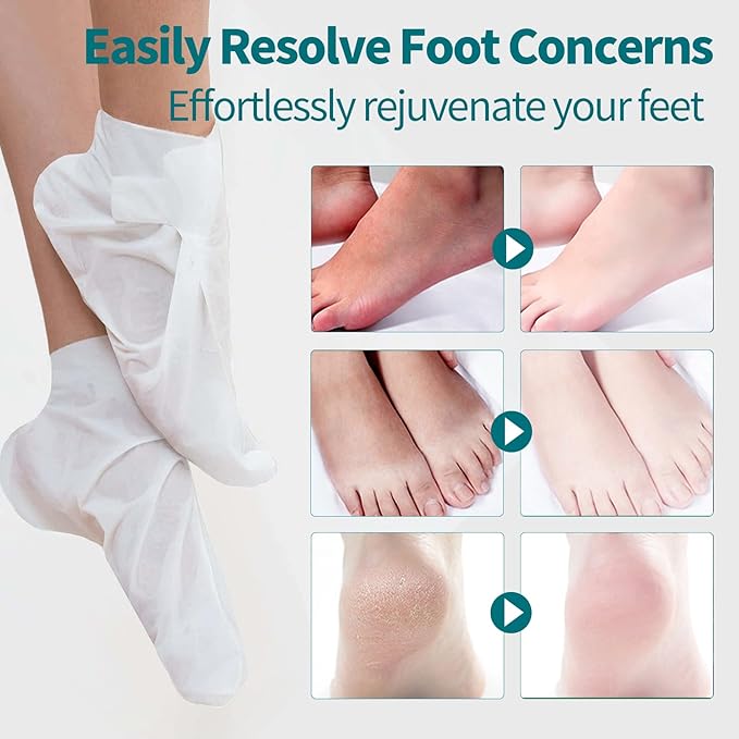 Moisturizing Foot Mask 5 Pack,Hydrating Foot Masks for Dry Cracked Feet,Moisturizing Socks Dry Skin Moisturizer for Soft and Smooth Touch Feet,Foot Care Spa Gifts for Women Men Mother's Day Gifts