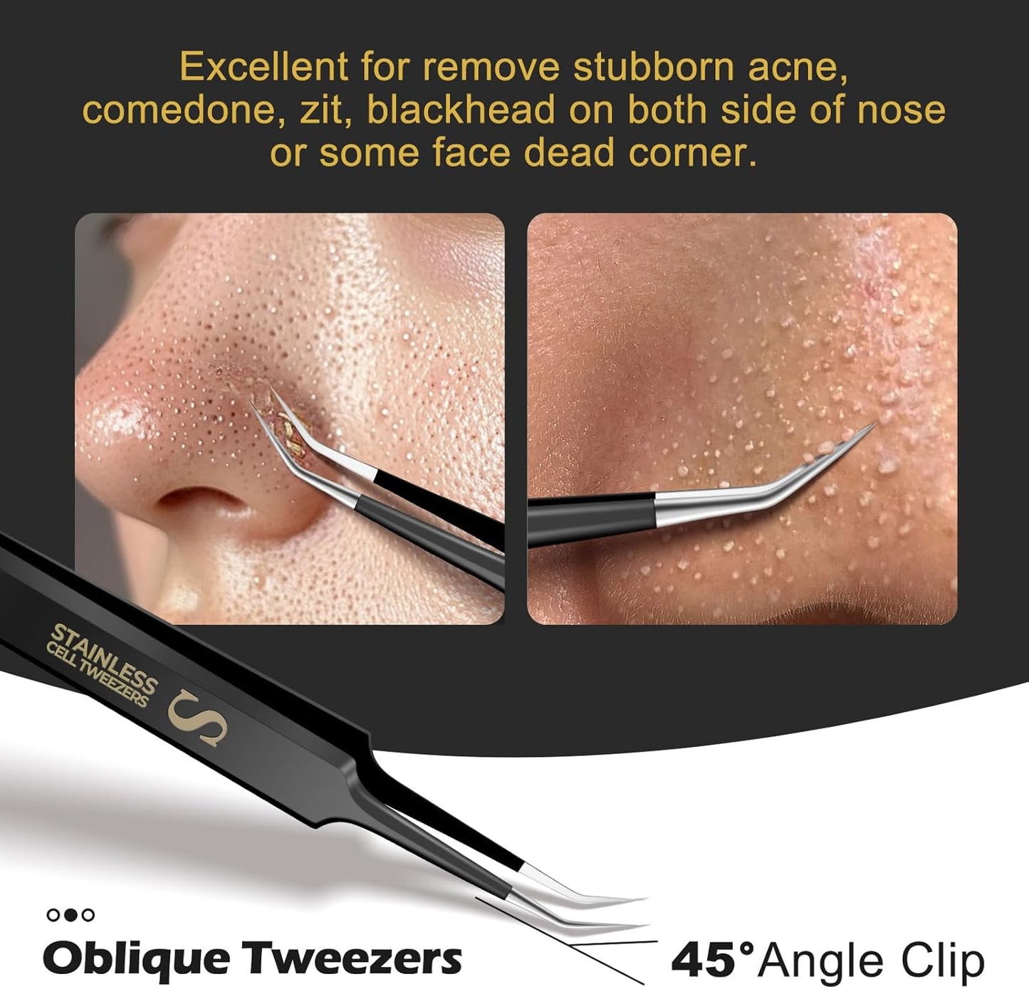 WSYUB Professional Blackhead Tweezers and Ingrown Hair Tweezers, Stainless Steel Blackhead Remover Tools, Tweezer for Women Facial Hair