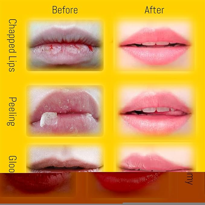 Honey Pot Lip Balm for Dry Cracked Lips - Strawberry Scrub Exfoliator & Moisturizer, Hydrating With Wand, Lip Sleeping Mask (4pcs)