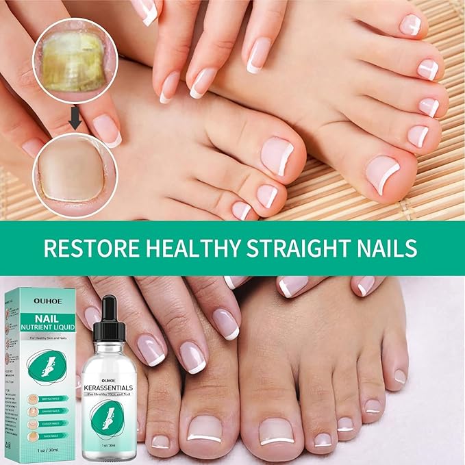 Kerassentials Toenail Oil, Kerassentials Nails Nutrient Oil, Nail Repair Solution 30ML/1PCS (4PCS)