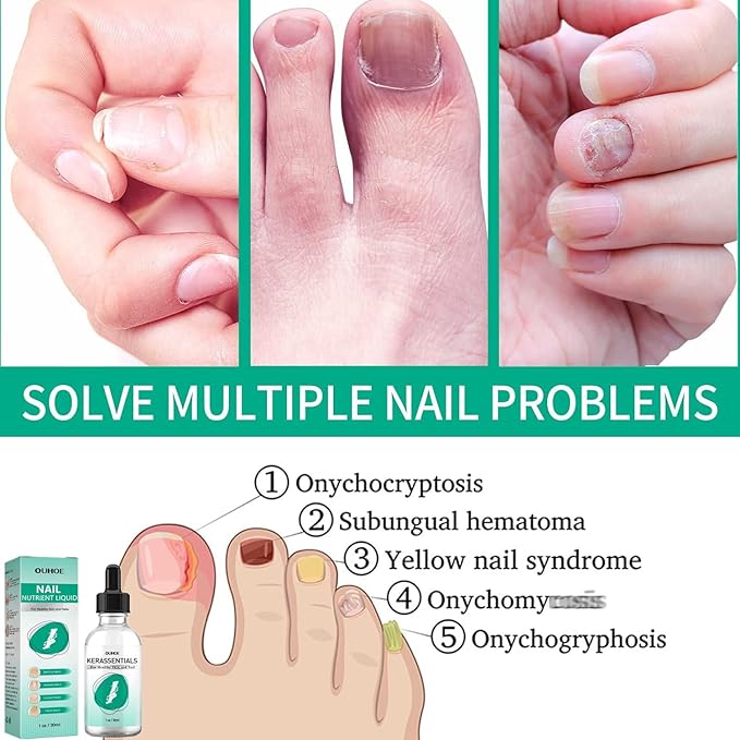 Kerassentials Toenail Oil, Kerassentials Nails colourless (3PCS)