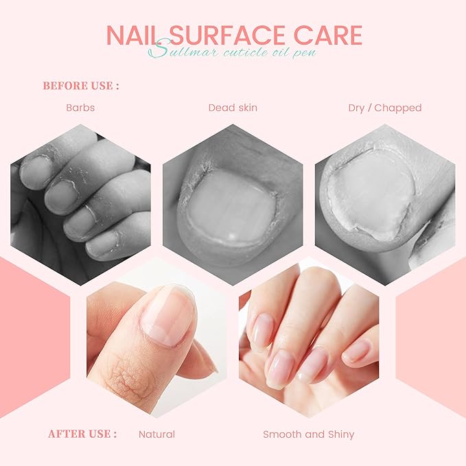 Nail Nutrition Pen - 5pcs Cuticle Oil Pen for Nail Strengthening & Care (DIY & Salon)