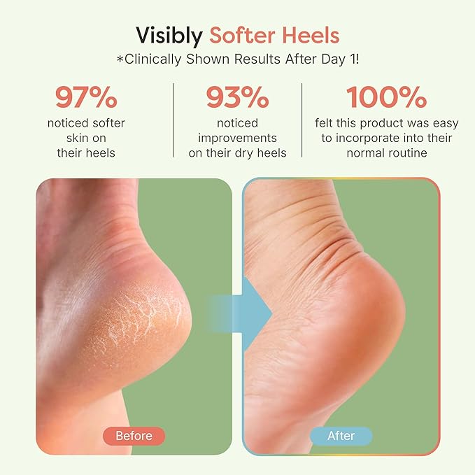 ZenToes Moisturizing Socks for Cracked Heel Treatment - Vitamin E, Olive Oil and Jojoba Oil Infused Heel Socks to Soften and Hydrate (Holiday Stripes, Regular)