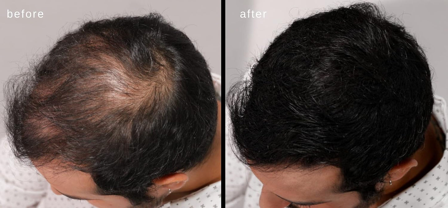 LUXE Hair Building Fibers - Thickening Fibers - CONFIDENCE IN A JAR – 2 Months+ Supply! – Hypoallergenic, Dermatologist Tested – Multiple Colors Available (Gray)