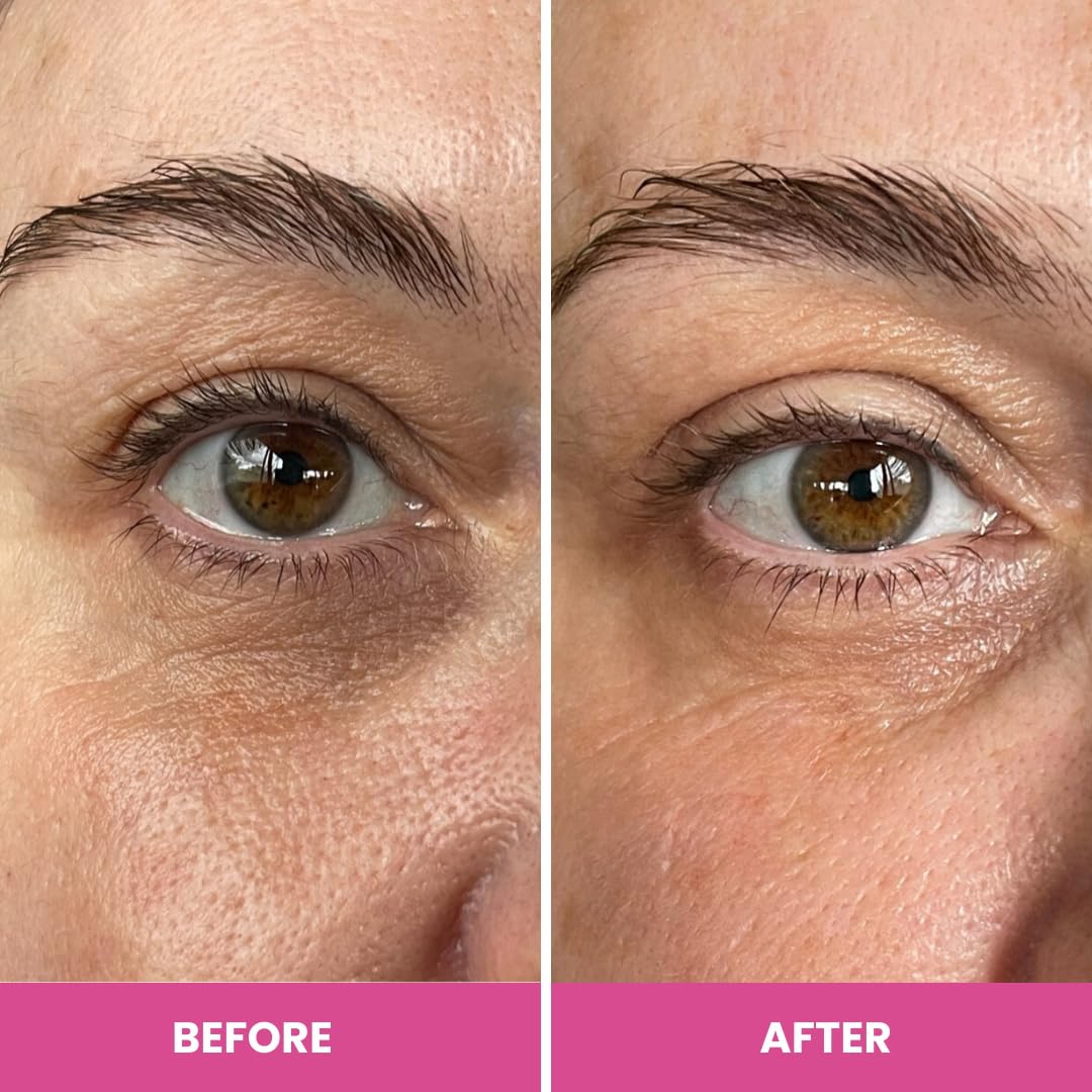 PRIME PROMETICS PrimeEyes Hydrate Under Eye Cream for Mature Women – Hydrating Eye Cream for Dark Circles and Wrinkle Repair – Soft, Glowing & Healthy Under Eyes