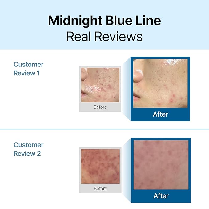 DearKlairs] Midnight Blue Calming Cream, Soothing, Redness Relief Moisturizer, Hydrating, Fast Absorbing, Light Texture for Easy Use, Sensitive Skin Friendly (1.01 Fl Oz (Pack of 1))