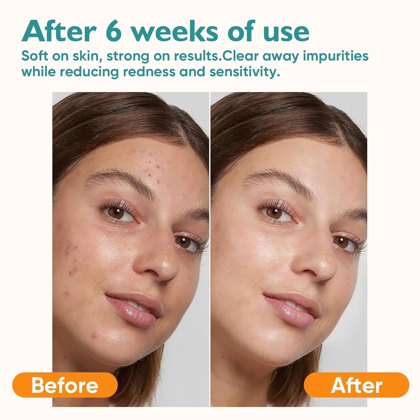 Face Towels, 400 Count Disposable Face Towelette for Washing Face, Skincare, Ultra Soft Facial Towel for Sensitive Skin, Lint-free Makeup Remover Dry Wipes - 8 Box