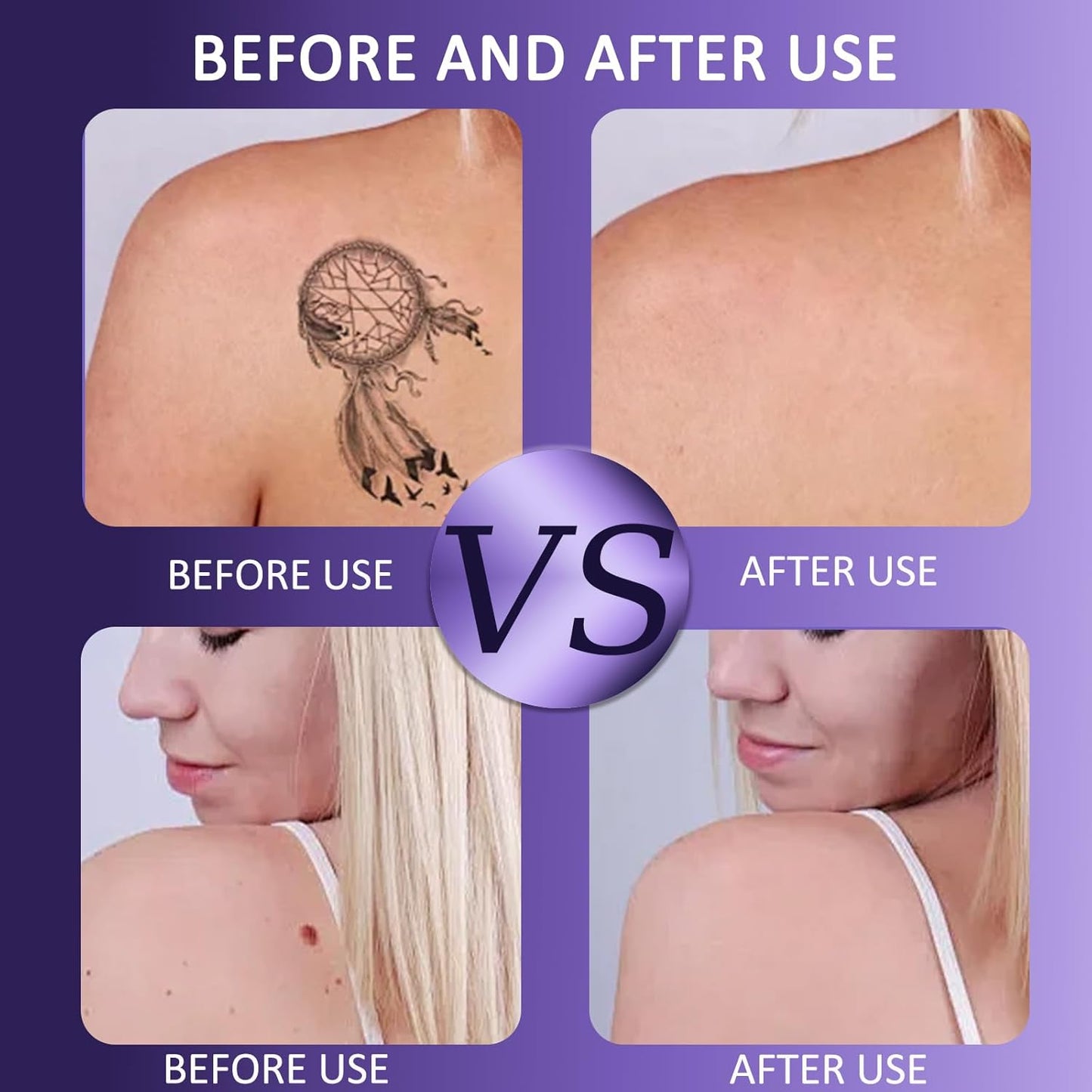 Leg Makeup Waterproof - Coverage for Scars & Blemishes, No Transfer, Lightweight & Long-Lasting, Natural Radiance (01)