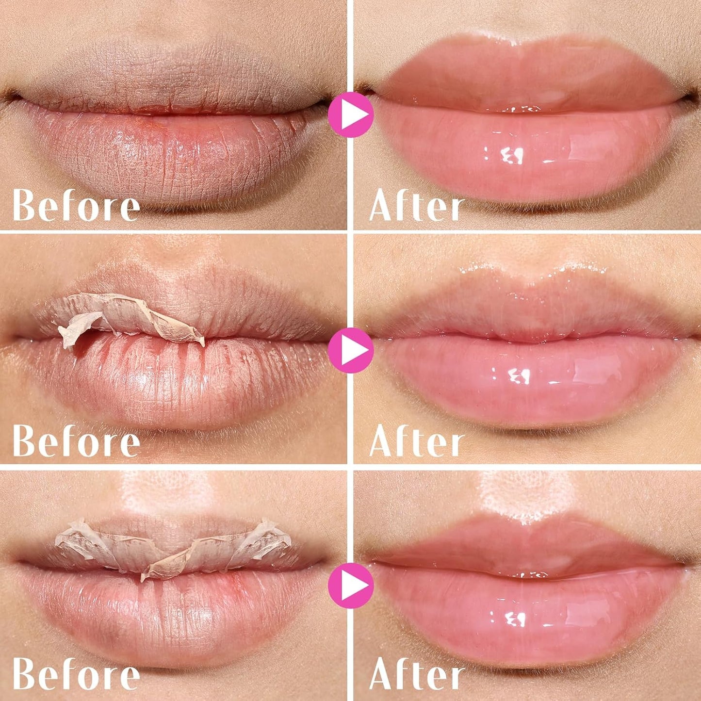 KIMUSE Lip Mask, Lip Sleeping Mask: Moisturizing, Hydrating, Nourishing Lip Care Products, Vitamin C, Shea Butter & Antioxidants, Lip Mask Overnight Set for Dry Lip, Flaky