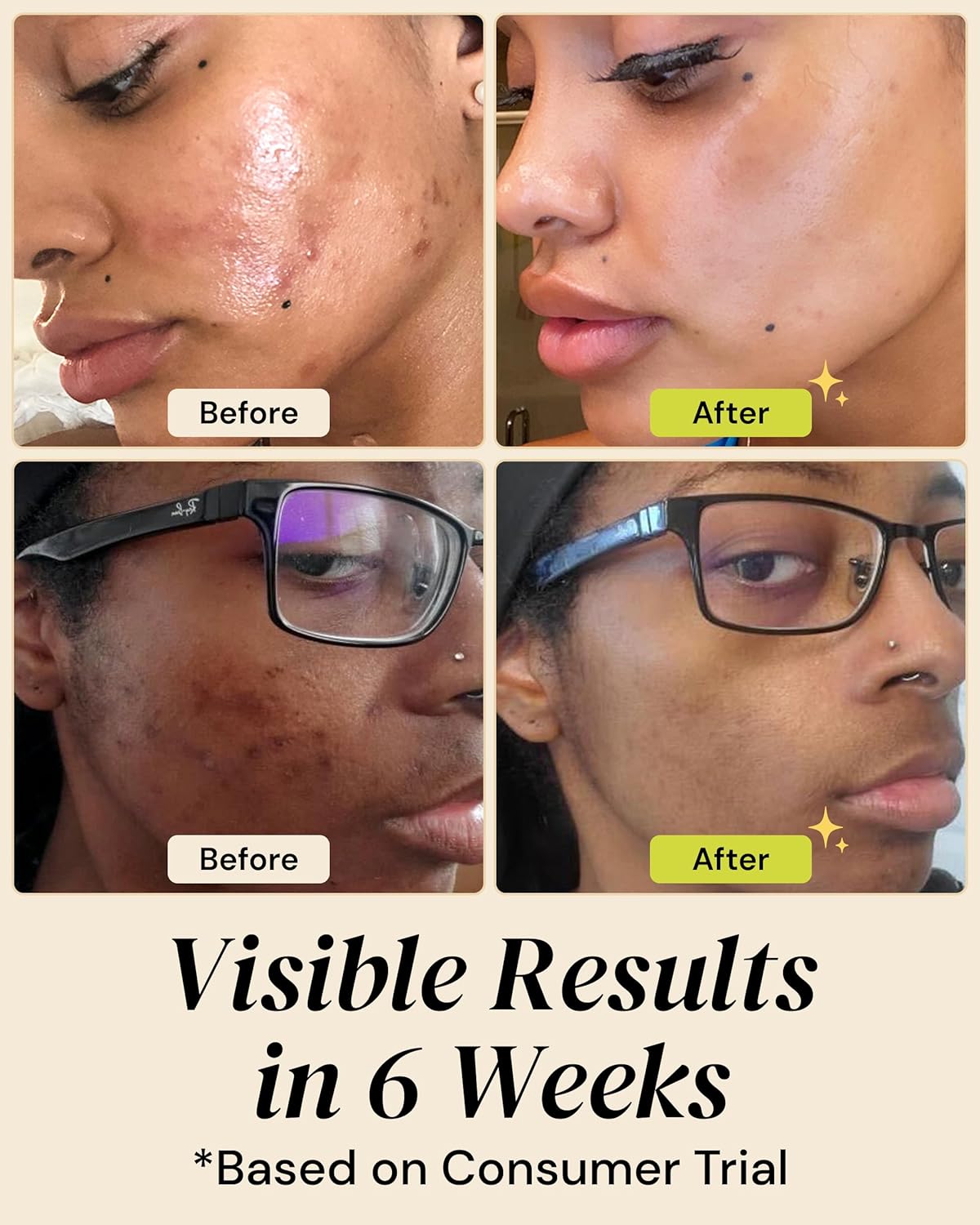 Gleamin Brightening Skincare Bundle – Mask, Serum, Cleanser, Moisturizer & Oil for Dark Spots, Uneven Tone, and Glowing Skin – Complete Vitamin C Skincare Routine