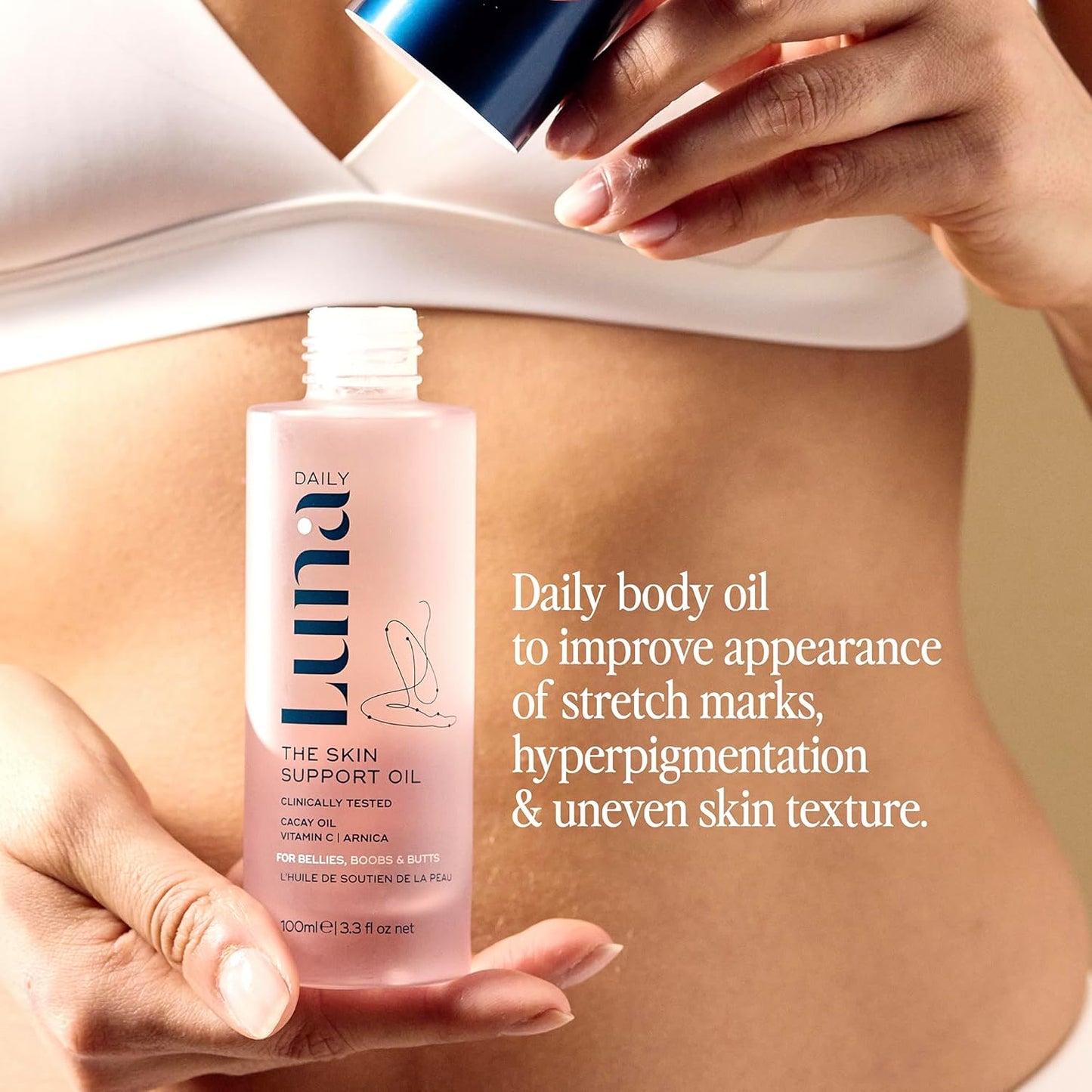 Luna Daily Stretch Mark Body Oil | Hydrating Treatment for Scars, Discoloration & Uneven Skin Texture | Vitamin C & Coconut Oil Nourish Dry Skin | Clinically Proven, Pregnancy Safe for Women, 300ml