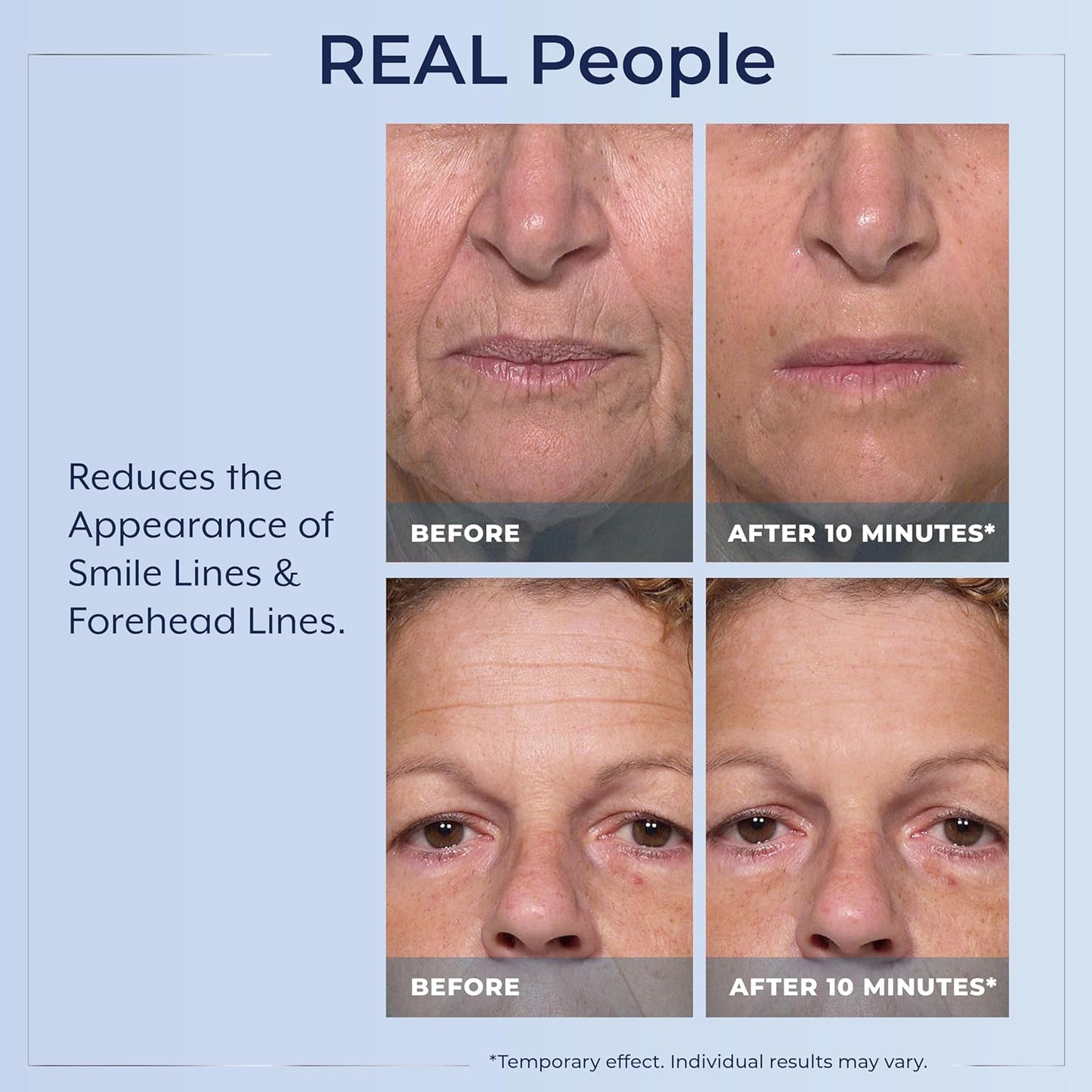 Plexaderm Rapid Reduction Eye Serum - Visibly Reduces Under-Eye Bags, Wrinkles, Dark Circles, Fine Lines & Crow's Feet Instantly, Anti Aging Wrinkle Remover for Face, Full Size Tube