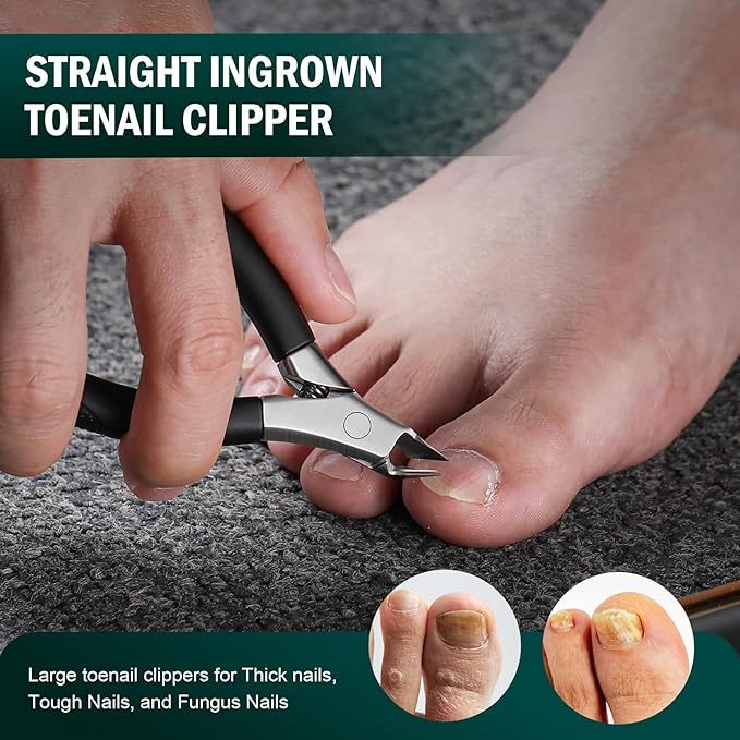 FVION Ingrown Toenail Tools Kit 5 Pcs, Toenail Clippers for Thick & Ingrown Nails, Ingrown Toenail Removal Correction Nail Clippers, Nail File Lifter, Professional Manicure Pedicure Tools