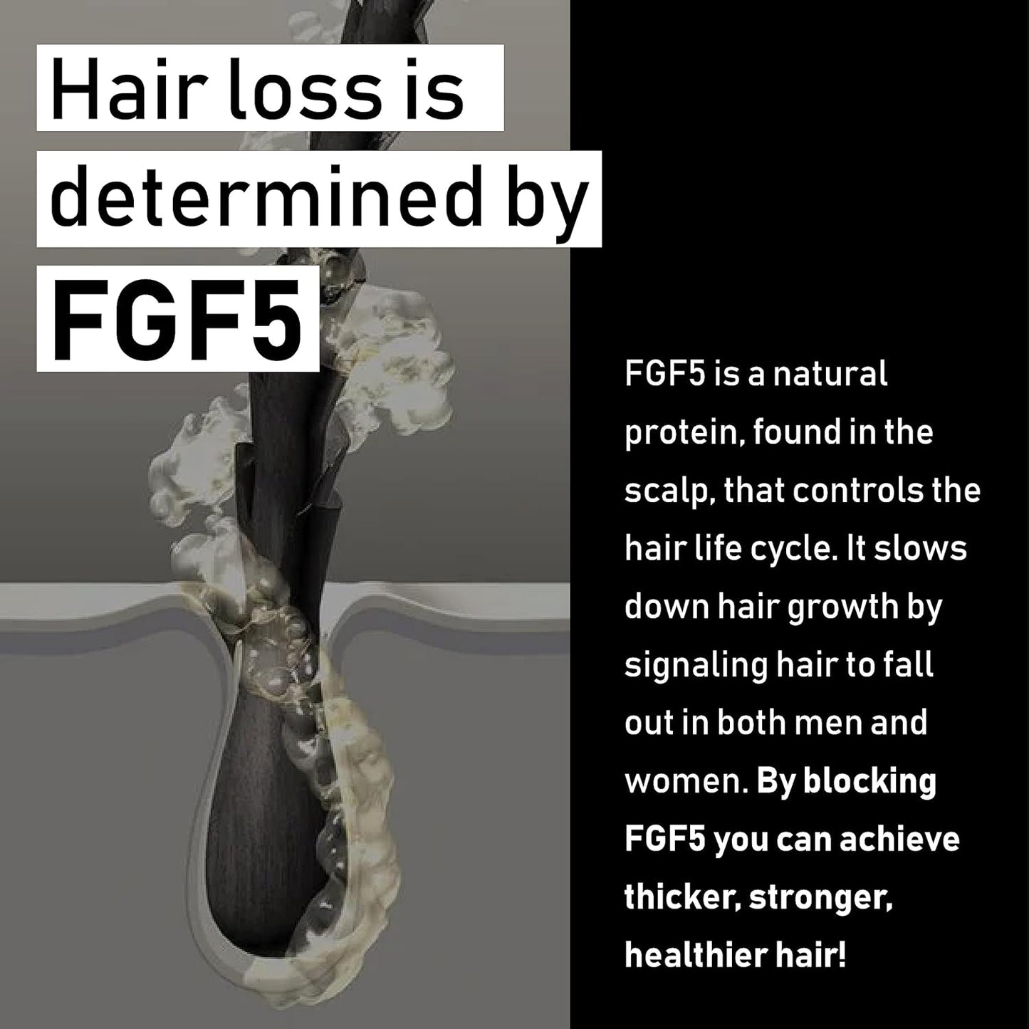 EVOLIS Promote Nourishing Treatment Mask - Deep Conditioning Hair Mask to Support Hair Growth - Hydrating Hair Mask for Dry, Damaged Hair (8 fl oz)