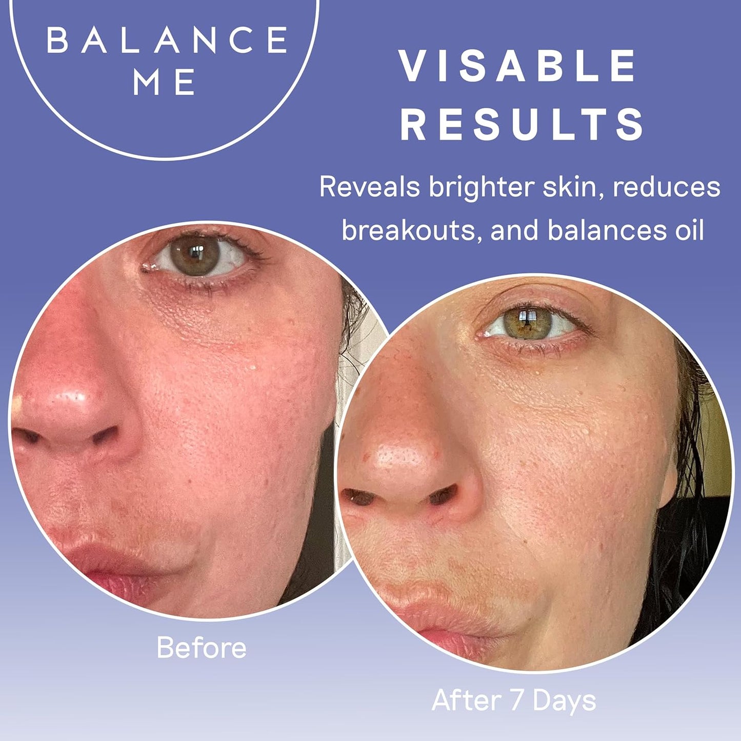 Balance Me Pure Skin Face Wash, Gentle Foaming Facial Cleanser with Moringa & Rice Bran (1 x 4.23 fl oz), Non Toxic Water-Based Facewash for Oily, Blemish-Prone & Sensitive Skin