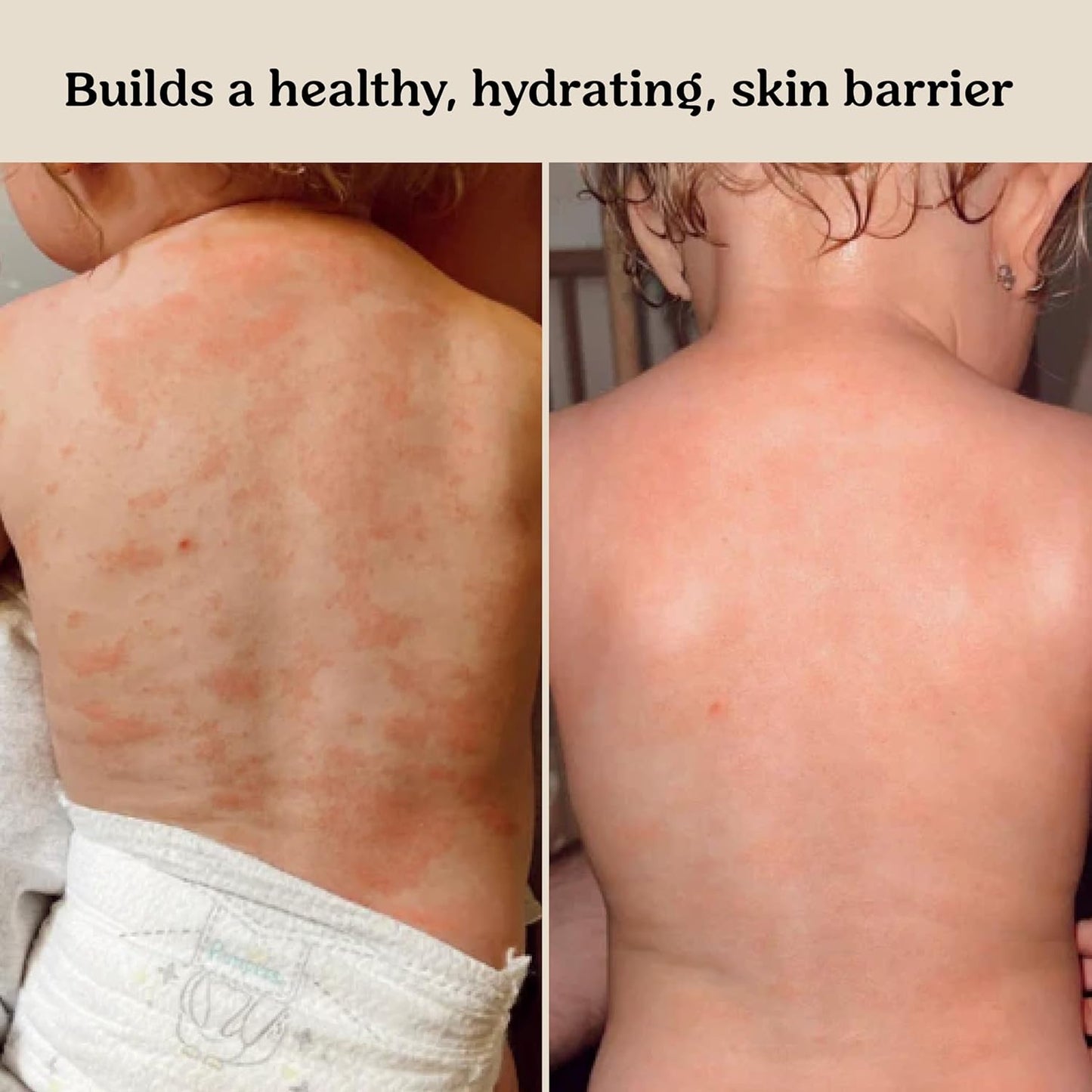 Roe Wellness- Baby Cream Lotion Ointment EWG Verified Non-Toxic Ingredients | Full Body Biome Barrier | Dry Skin, Itch Relief, Moisturizing, All Over Ointment | Toddlers & Kids