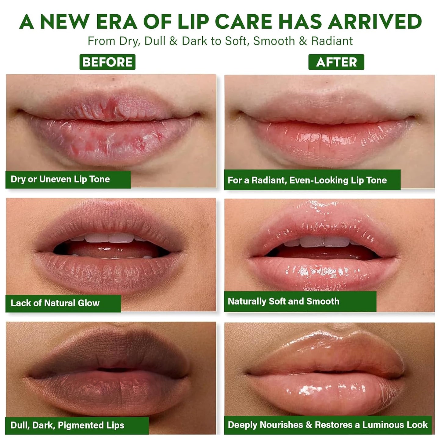 Vegan Lip Brightening Balm – Ayurvedic Lip Care for Dark & Smoker Lips | Deeply Hydrating & Moisturizing & Nourishing with Rich Antioxidants – Clean Beauty Plant-Based Formula