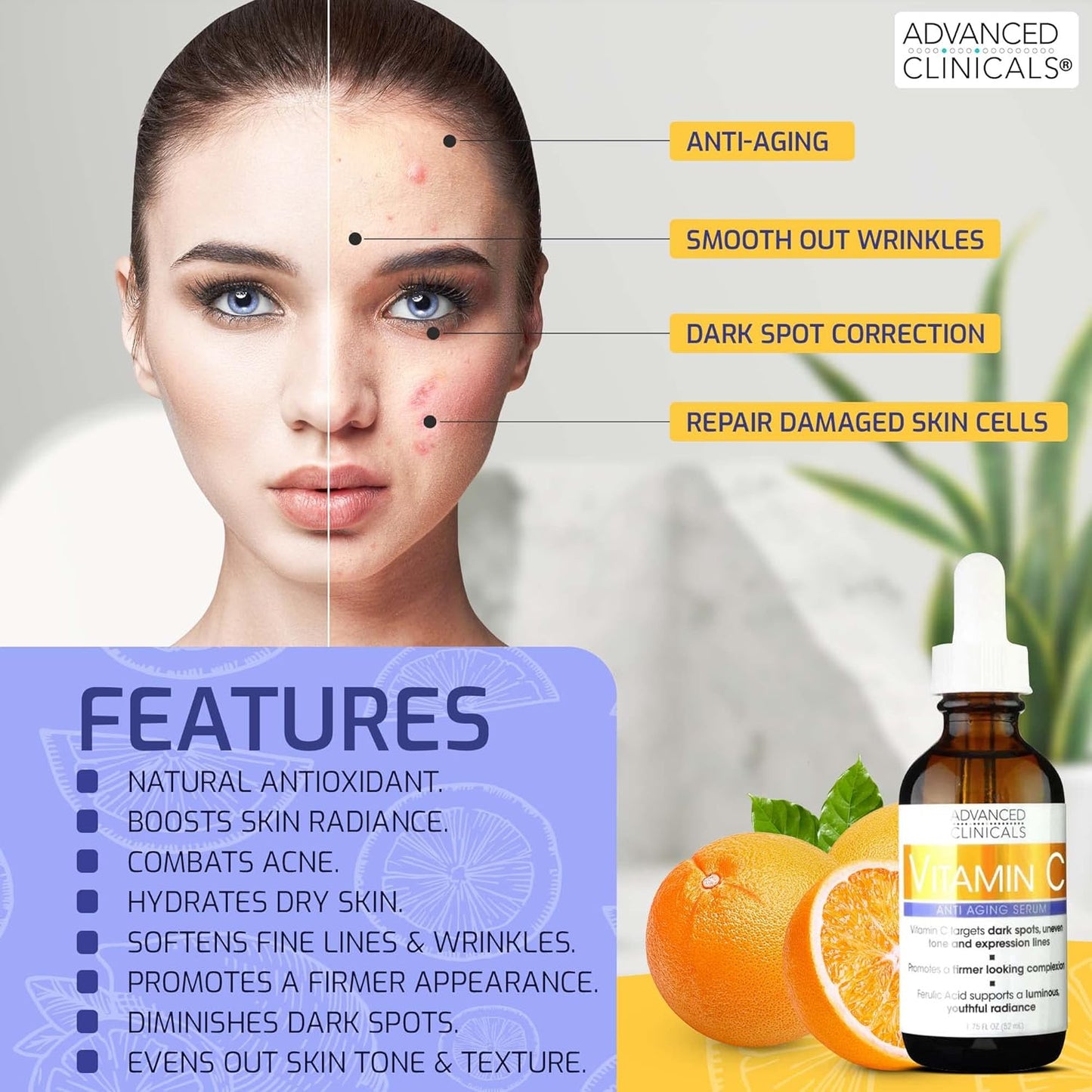 Advanced Clinicals Brightening Vitamin C Serum For Face With Glycolic Acid + Lactic Acid | Vitamin C Eye Serum Face Moisturizer For Improving Look Of Dark Spots & Uneven Complexion, 1.75 Fl Oz