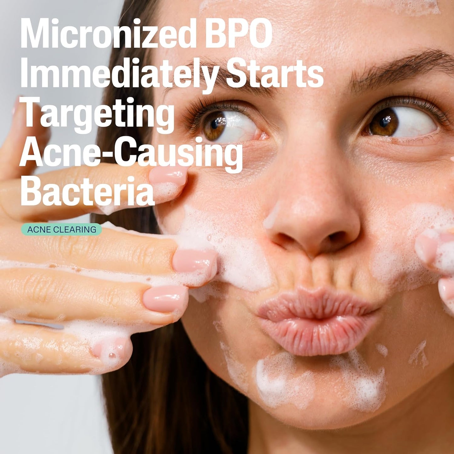 Cetaphil Gentle Clear Complexion-Clearing BPO Acne Cleanser with 2.6% Benzoyl Peroxide, Creamy and Soothing for Sensitive Skin, Suitable for All Skin Types, 4.2oz