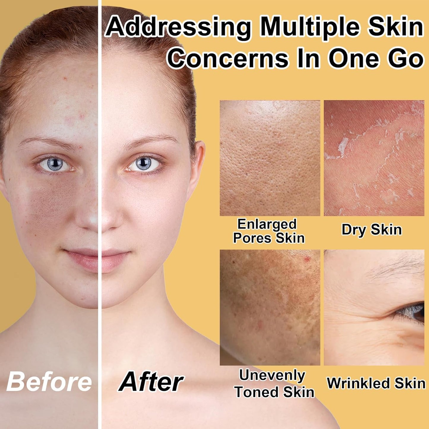 Skin Care Set for Women Teen 6 Pcs - Hydrating & Anti-Aging Facial Routine Skincare Products,Cleanser,Toner,Retinol Serum,Niacinamide Hyaluronic Acid Serum & Face Cream - Gifts Women Christmas