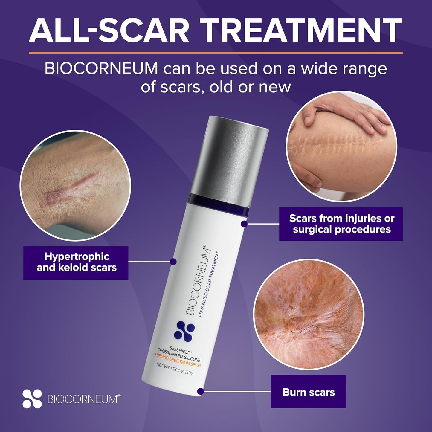 Advanced Scar Treatment with Silishield® & SPF 30 20g - Surgeon-Approved Silicone Scar Gel for Surgical Scars Ideal for Adults & Kids – New & Keloid Scar Treatment & Scar Removal Cream for Old Scars
