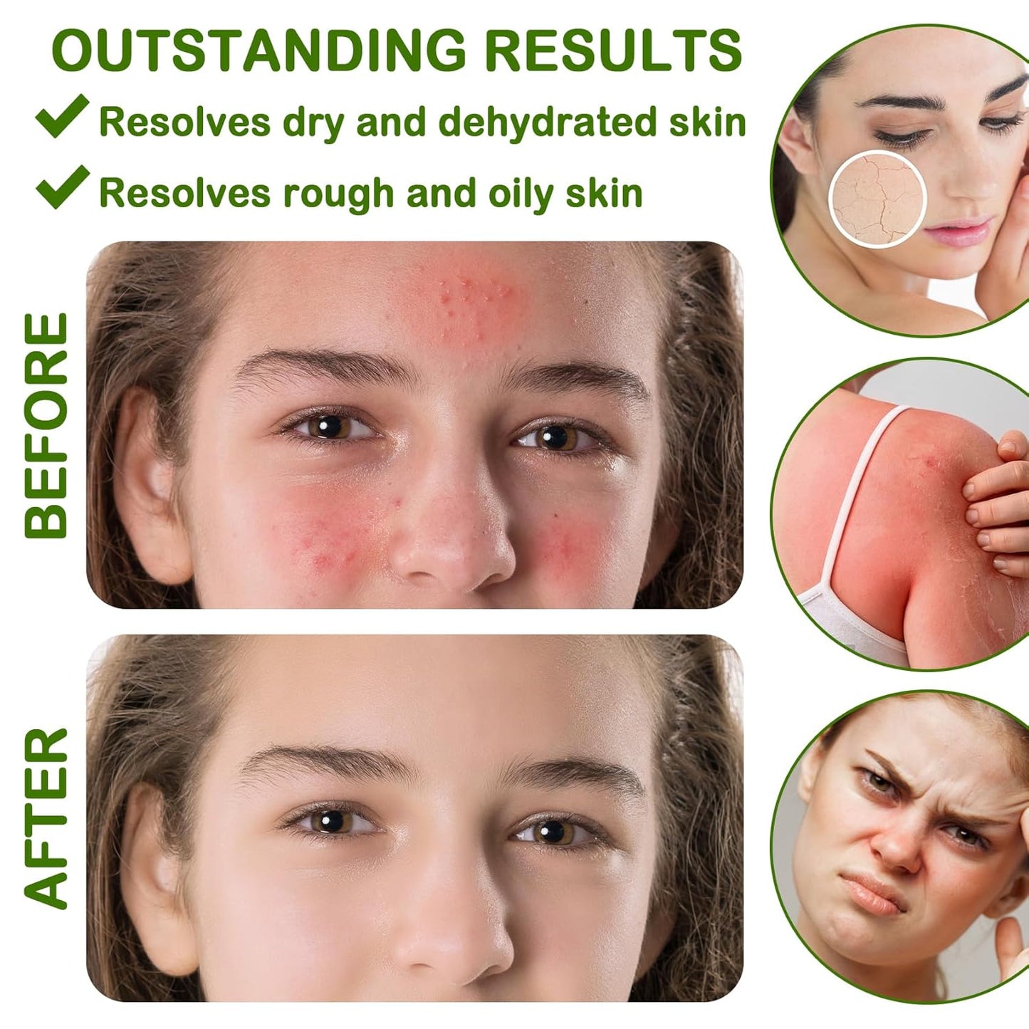 8PCS Organic Aloe Vera Gel for Face & Body,Moisturizing Non-sticky Pure Aloe Gel After Sun Aloe Lotion Skin Care,Fast Absorbing Long Lasting Refreshing Hydrating Face Moisturizer for All Skin Types C