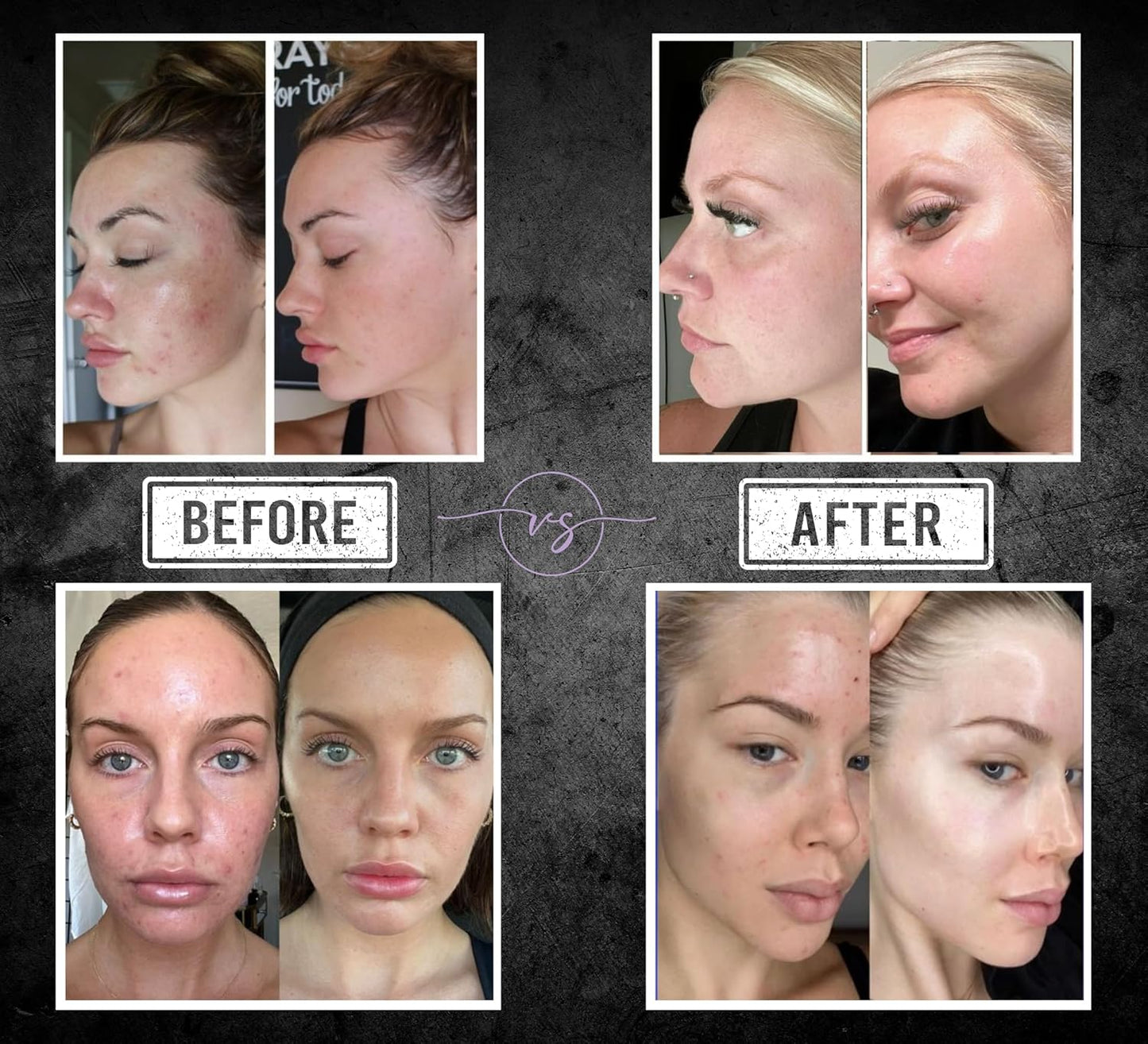 Kojic Lavender Night Edition 50+ Ingredients Face Body Bar with Melatonin, Night Repair Peptides Skin Care Bar with Ceramides, Essential Oils, Vitamin C, Retinol Cleansing and Hydration All Skin Types