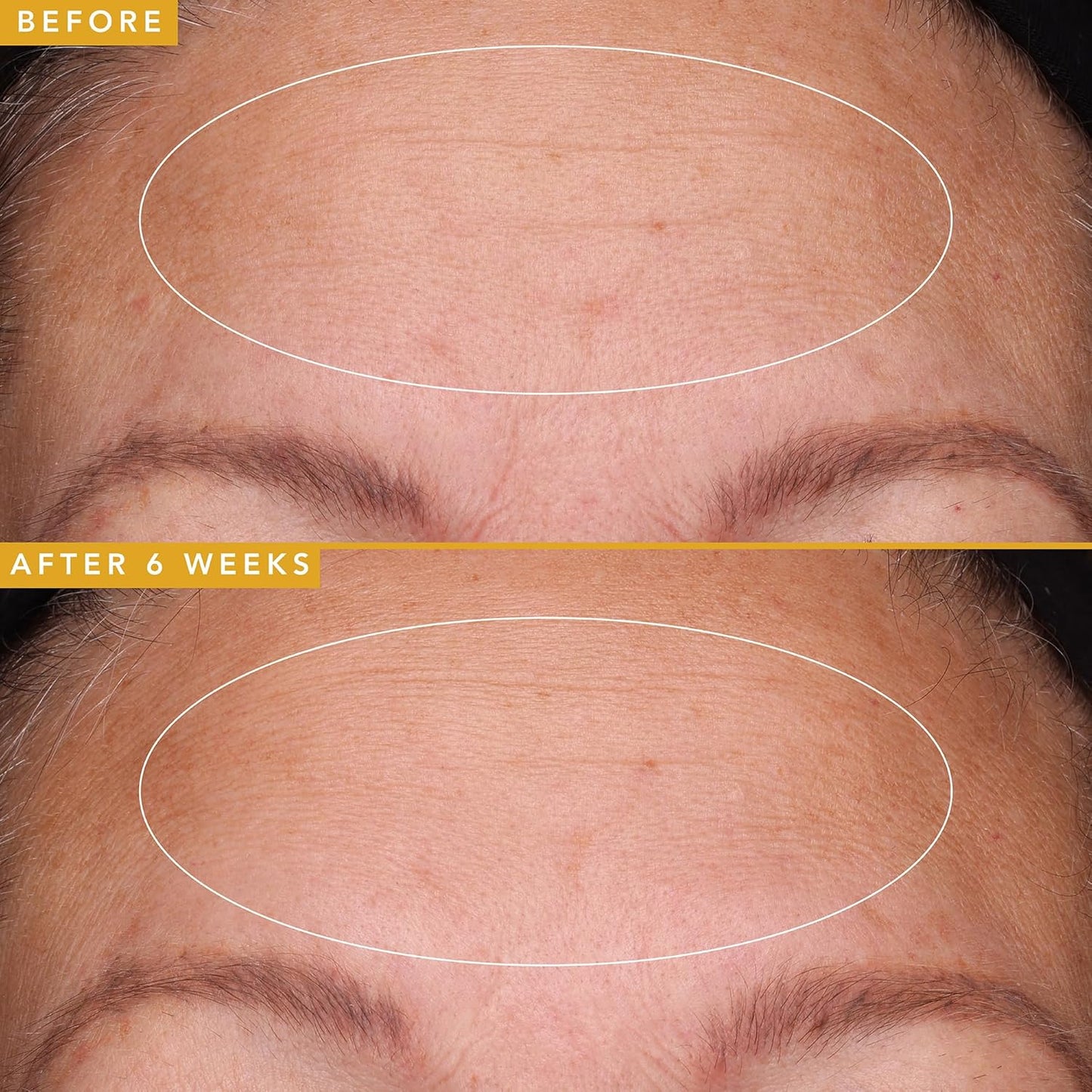 Farmacy Filling Good Hyaluronic Acid Serum for Face - Anti Aging Skin Care + Hydrating Face Serum - Plumps, Smoothes & Helps to Visibly Improve Skin Firmness for a Youthful Complexion (5ml)