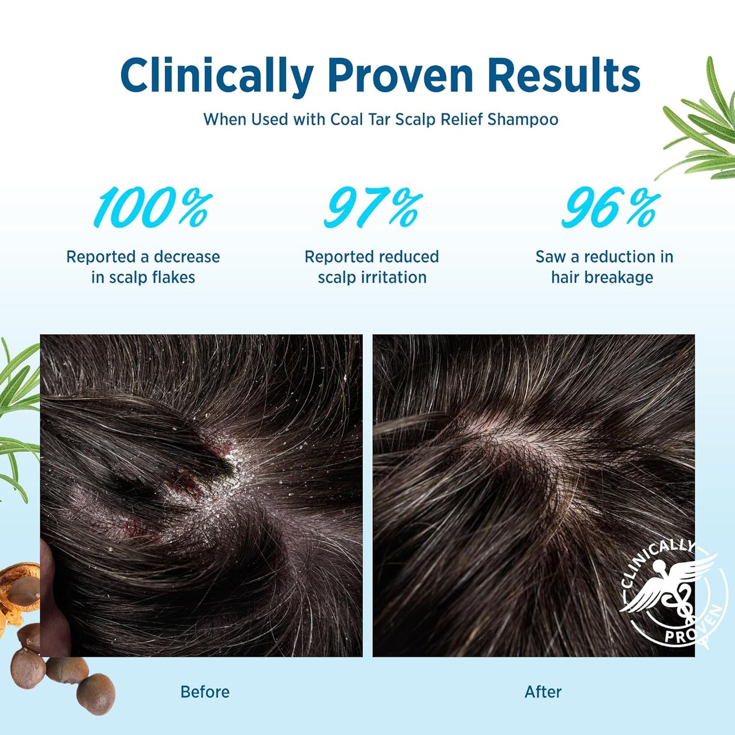 Roycederm Scalp Relief & Moisture Conditioner: Hydrating & Nourishing Formula with Jojoba Oil, Aloe Vera & Camellia Oil, Soothes Dry, Itchy Scalp