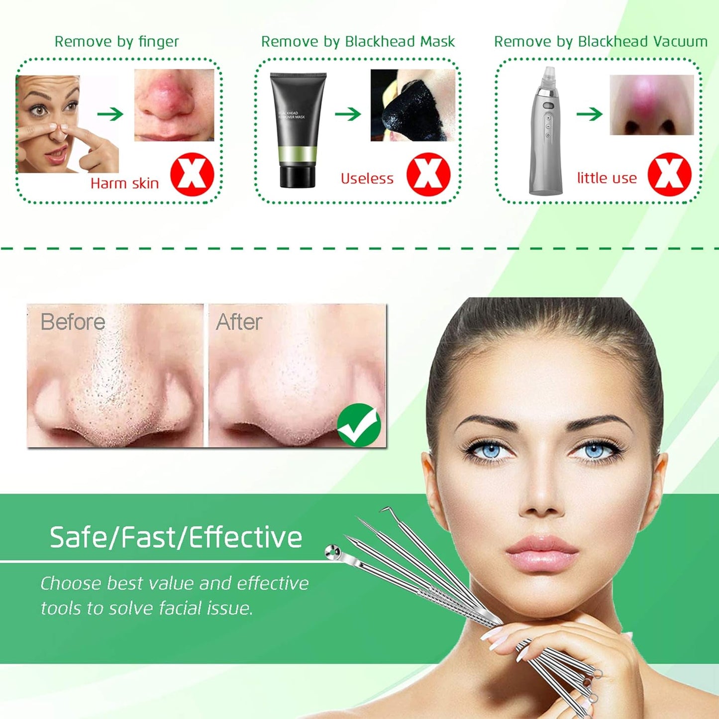 5PCS Blackhead Remover Comedone Extractor, Curved Blackhead Tweezers Kit, Professional Stainless Pimple Acne Blemish Removal Tools Kit for Manual