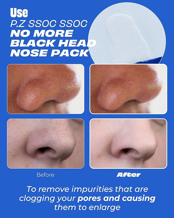 One-day's you P.Z SSOC SSOC No More Blackhead Nose Strips Sebum & Pore Care | Hypoallergenic Korean Nose Mask Blackhead Remover Clogged Pore Tightening Skin Care w/Centella Asiatica (0.07 oz, 5 EA)