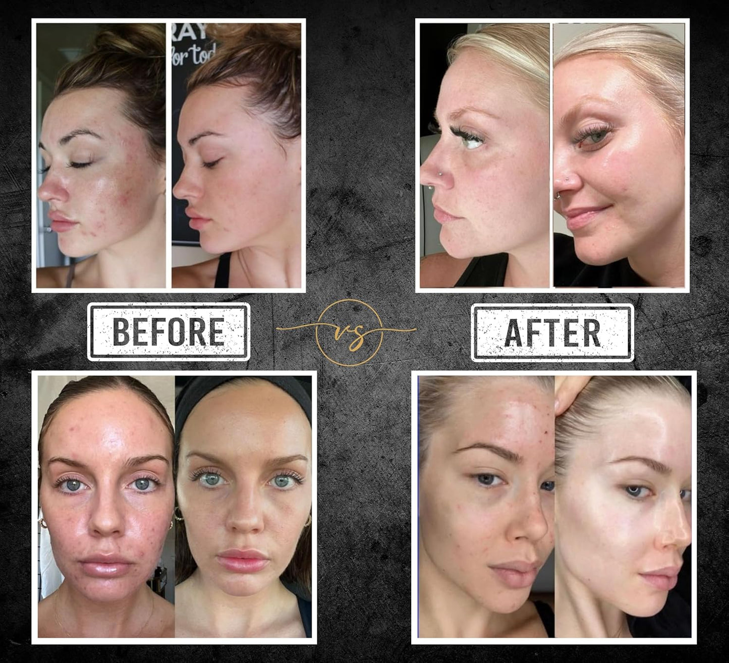 Kojic & Turmeric 300g Korean Formula 42 Professional Grade Ingredients Face and Body Bar Soap – Skin Care Bar with Salicylic Acid, Vitamin C, Retinol – Gentle Cleansing and Hydration All Skin Types