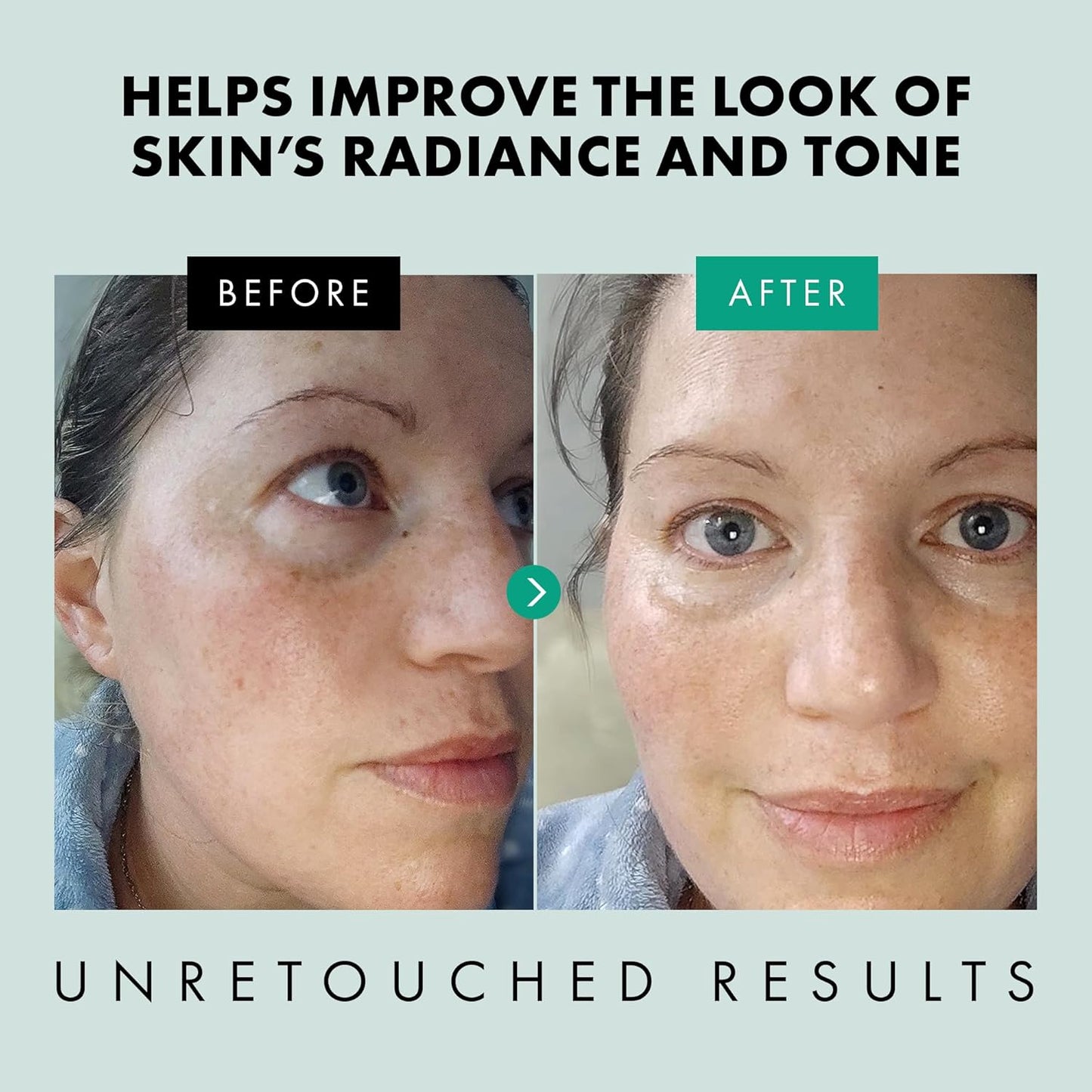 Eclat Skincare Clarifying Niacinamide Serum - 12% Niacinamide with Zinc PCA & Hyaluronic Acid - Hydrating & Soothing Formula - Facial Serum for Minimizing Pores and Improving Skin Texture 1 Fl Oz