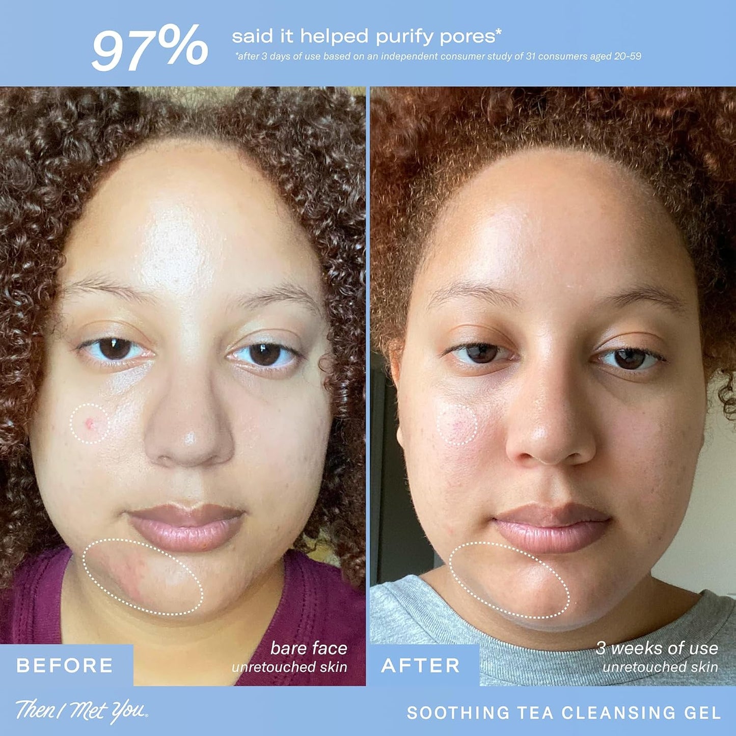 Then I Met You Soothing Tea Cleansing Gel, Vegan-Cruelty-Free Korean Skincare Cleanser with Fermented Rice, Centella, Hydrating Licorice, Glycerin, Exfoliator for Clear Skin Makeup Removal, 3.38 oz